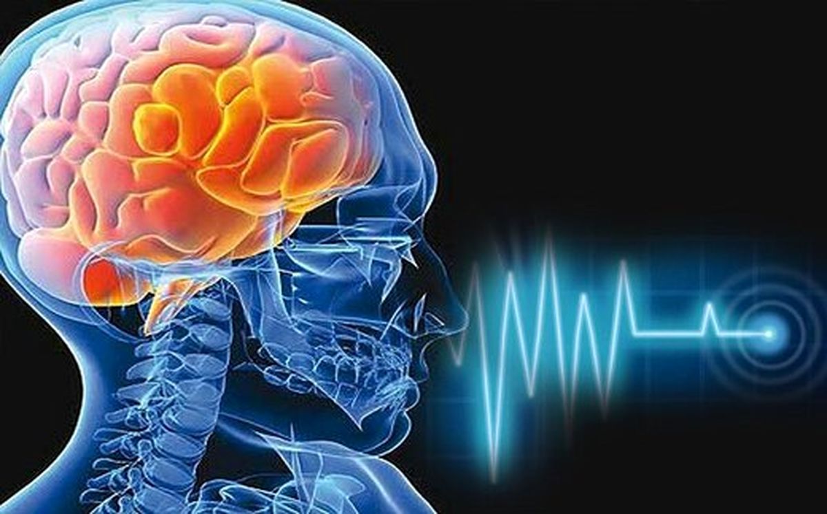 واکسن آنفلوآنزا خطر سکته مغزی را کاهش می دهد؟
