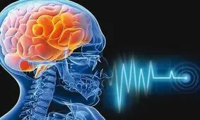 واکسن آنفلوآنزا خطر سکته مغزی را کاهش می دهد؟