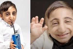 جوان ایرانی با کوچک‌ترین دست‌های دنیا رکورد زد