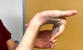 انعطاف پذیری بیش از حد انگشتان خوب است یا بد؟