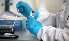 تست ۵ بیمار مشکوک به آبله میمونی منفی شد/ ۴ بیمار دیگر در انتظار نتیجه آزمایش‌ها