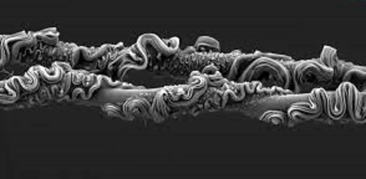 شاهکارهای عکاسی که برندۀ جایزه شدند؛ از «تار عنکبوت» تا «پروانه‌ای شبیه مار» 