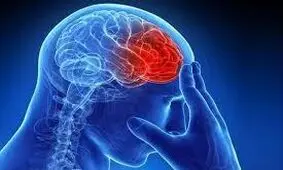 راهکاری برای کاهش خطر سکته مغزی