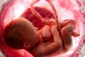 سقط جنین چه عوارضی برای سلامت زنان دارد؟