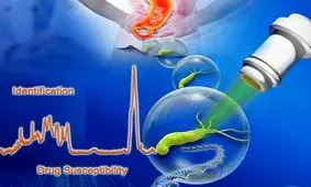 ابزاری جدید برای مقابله با باکتری های سرطان زای معده