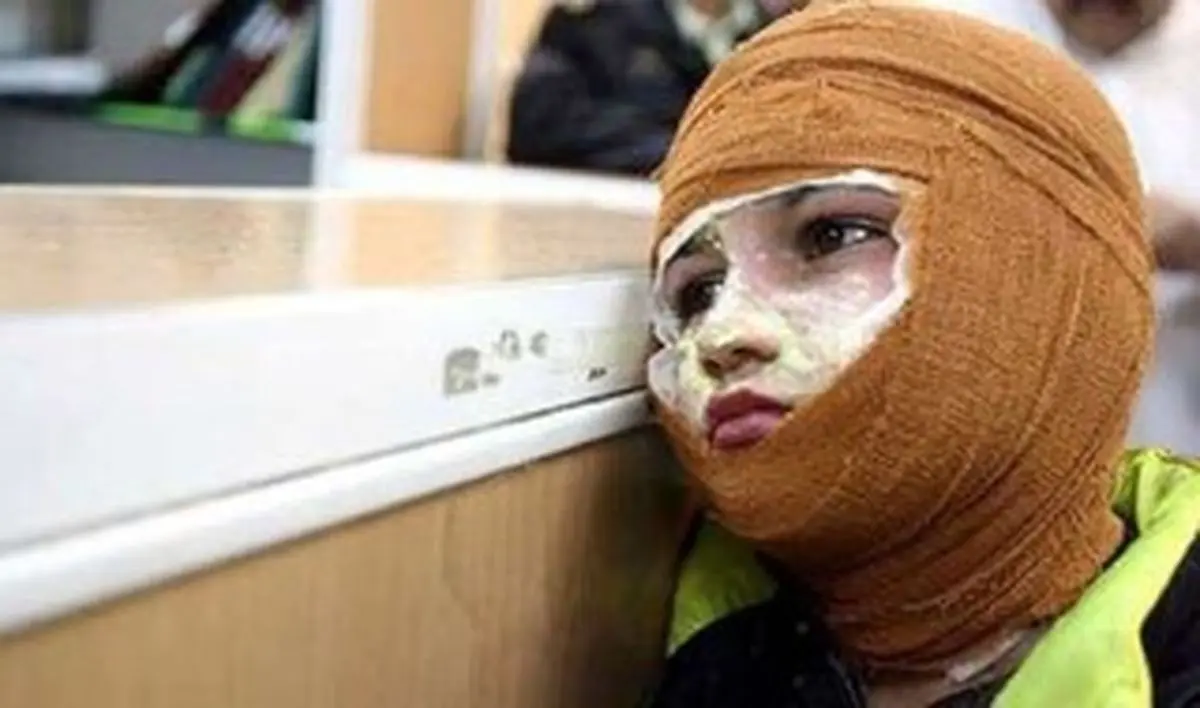 قیمت لباس سوختگی ۲ تا ۴۰ میلیون تومان