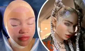 آیا همسر سابق ایلان ماسک بالاخره گوش هایش را شبیه اِلف‌ها کرده است؟