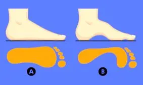 تست شخصیت شناسی/ با انتخاب یکی از این قوس های پا، ویژگی های پنهان خود را کشف کنید