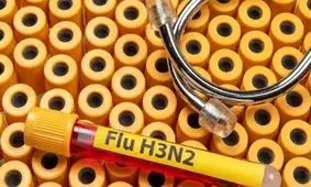 تشخیص سریع آنفلوانزا با کیت آزمایشی جدید

