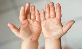 صدای پای یک بیماری خطرناک به گوش می‌رسد
