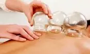 هشدار وزارت بهداشت درباره انجام خودسرانه حجامت