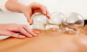 هشدار وزارت بهداشت درباره انجام خودسرانه حجامت