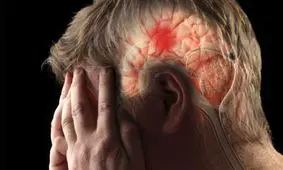 زنان و مردان در بروز سکته مغزی چه تفاوت هایی دارند؟