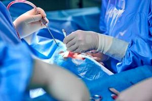 برای چهارمین بار در جهان؛ جراحی موفقیت آمیز پیوند سر در ایران
