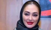 تصاویر باورنکردنی از چهره عملی الهام حمیدی