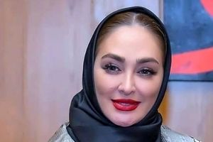 تصاویر باورنکردنی از چهره عملی الهام حمیدی