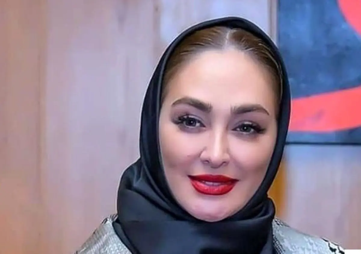 تصاویر باورنکردنی از چهره عملی الهام حمیدی