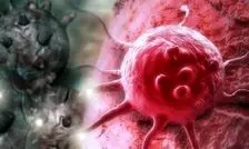 سامانه نانویی هوشمند تشخیص و درمان سرطان پروستات