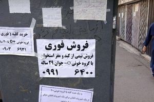 فروش کلیه شهروندان ایرانی به عراقی‌ها کذب است