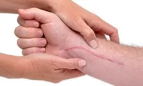 بهبودی جای زخم با تغییر ساعت شبانه روزی