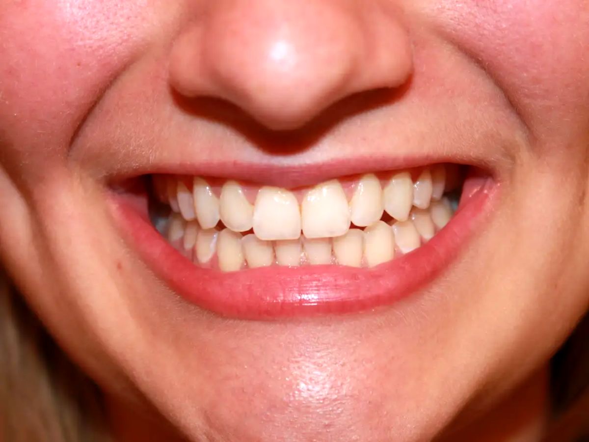 یک شرکت ژاپنی در مسیر تولید اولین دارو برای رویش دندان جدید