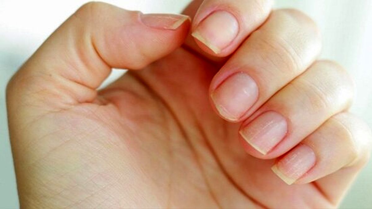  سبزیجات برگ دار تیره چگونه به سلامت و رشد ناخن ها کمک می‌کنند؟ 