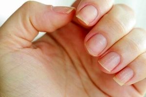 سبزیجات برگ دار تیره چگونه به سلامت و رشد ناخن ها کمک می‌کنند؟
