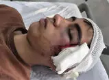 تنبیه ‌بدنی، دانش‌آموزی را در بم راهی بیمارستان کرد