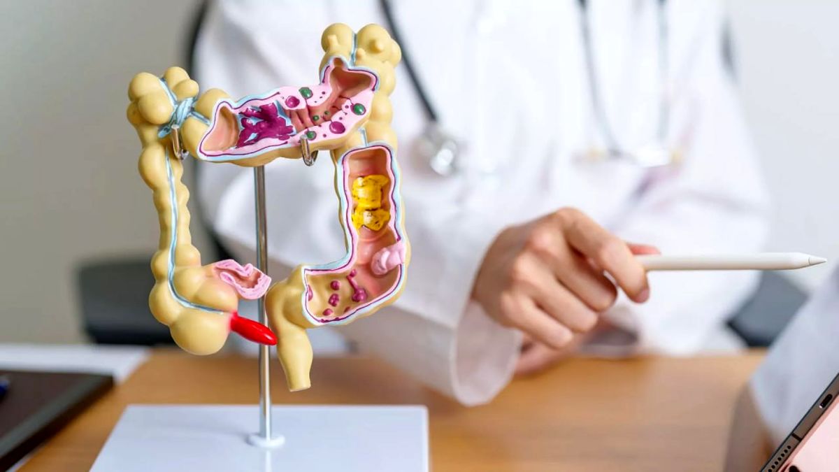 نتایج یک پژوهش جدید؛ افراد مبتلا به سرطان روده چگونه میتوانند مانند افراد عادی عمر کنند؟