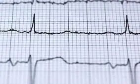 آیا آلودگی هوا بر آریتمی قلب تاتیر دارد؟