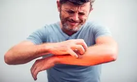 چه زمانی خارش بدن خطرناک است؟