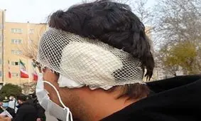 مرد ۵۰ساله با دندان گوش پسر جوان را در نانوایی ابوسعید کند