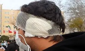 مرد ۵۰ساله با دندان گوش پسر جوان را در نانوایی ابوسعید کند