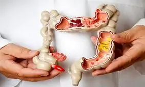 این 5 ماده غذایی دشمن یبوست هستند