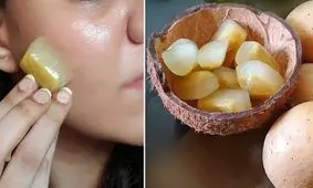 رفع تمام مشکلات پوستی با کمک ماسک یخ سیب زمینی