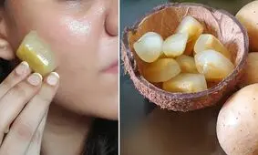 رفع تمام مشکلات پوستی با کمک ماسک یخ سیب زمینی