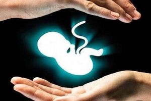 هر سال بیش از ۳۷۰ هزار سقط جنین در ایران رخ می‌دهد