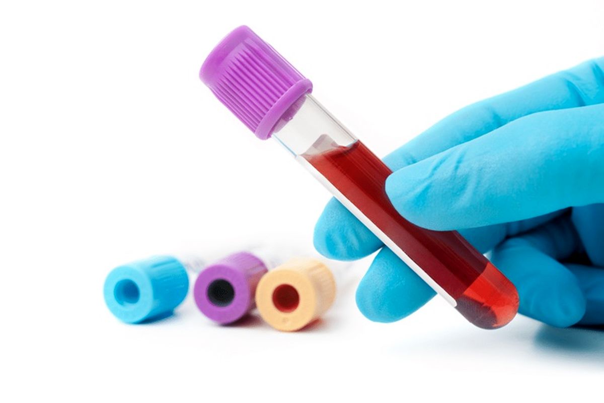 آزمایش WBC چیست و چرا تجویز می شود؟