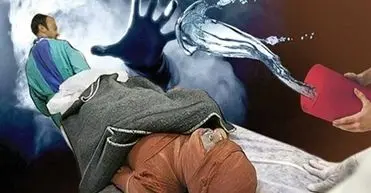 اسیدپاشی مرگبار به برادر