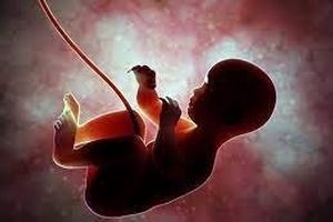مخالفت با غربالگری، نگرانی از افزایش سقط جنین/ تشخیص حداقل ۱۲ جنین سندرم داون در یک آزمایشگاه