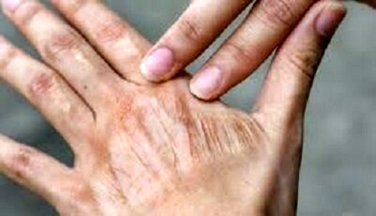 اشتباه های رایج در مراقبت روزانه از پوست