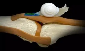 تسریع بهبود تاندون آسیب‌دیده با الهام از مخاط "لیسه"