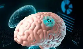 پیشگیری از اعتیاد به قمار با کاشت یک تراشه در مغز!/ عکس

