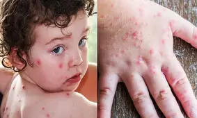 آنفلوآنزای گوجه فرنگی در کمین شماست