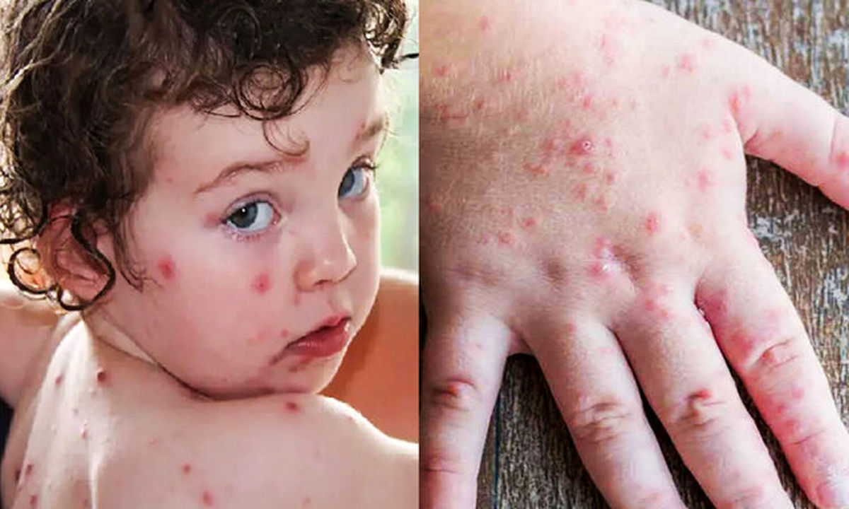 آنفلوآنزای گوجه فرنگی در کمین شماست