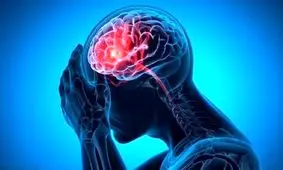 علائم خونریزی مغزی چیست؟