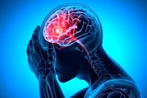 علائم خونریزی مغزی چیست؟