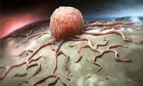 گرما رشد سلول های سرطانی را دشوار می‌کند