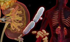 ناکارآمدی آنتی‌بیوتیک ها در درمان عفونت‌ ادراری