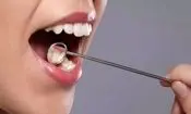 نیشکر، سپری جدید برای محافظت از دندان ها